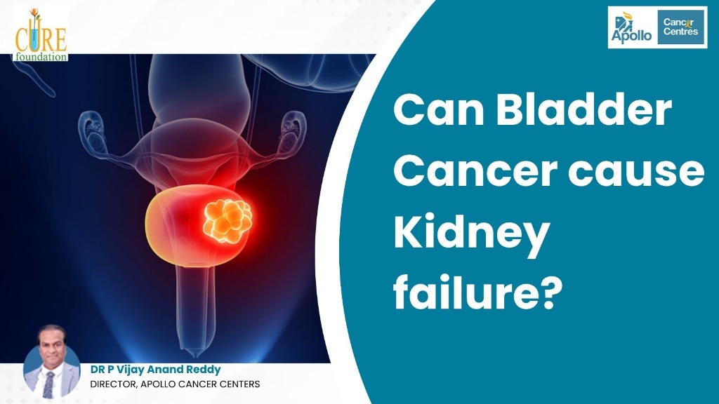Can Bladder Cancer cause Kidney failure?