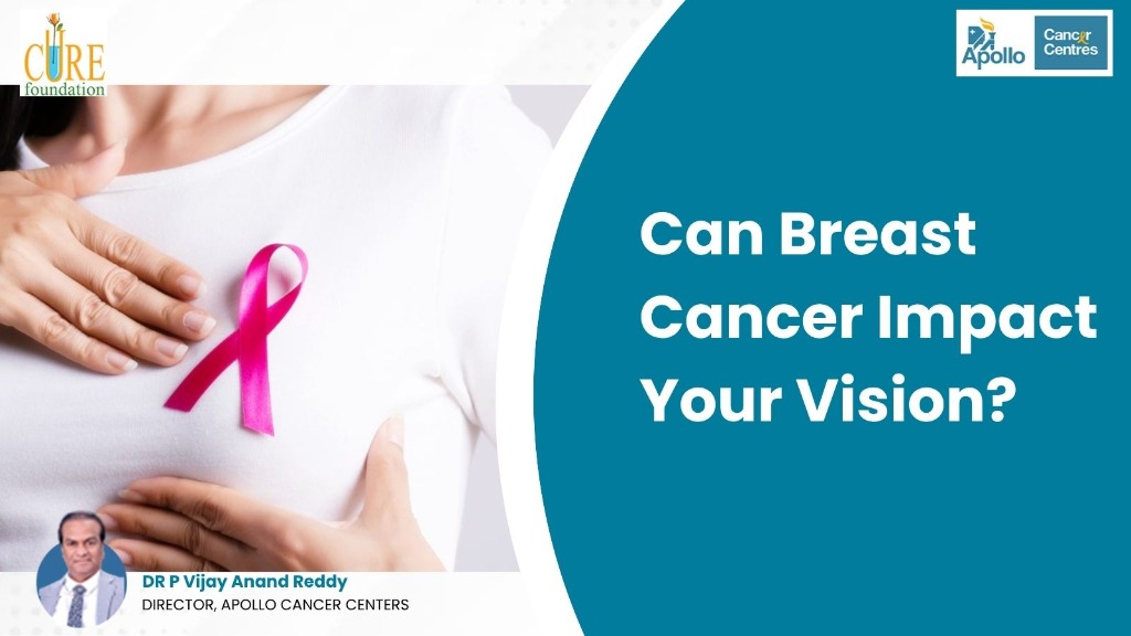 Can Breast Cancer Impact Your Vision? Uncovering the Connection