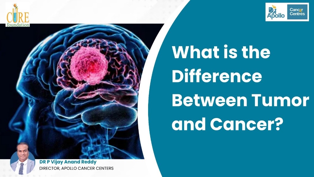 What is the Difference Between Tumor and Cancer? {Complete Guide}