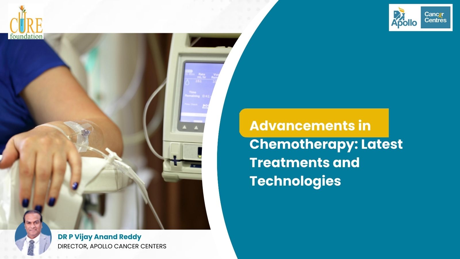 Advancements in Chemotherapy: Latest Treatments and Technologies