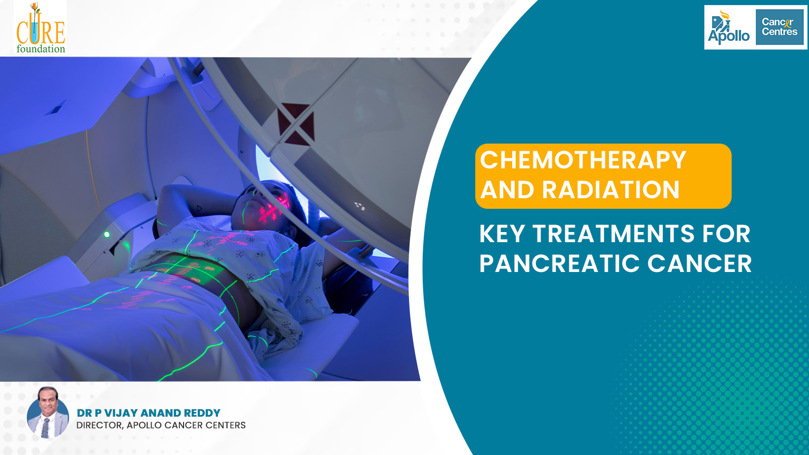 Chemotherapy and Radiation Therapy: Key Treatments for Pancreatic Cancer