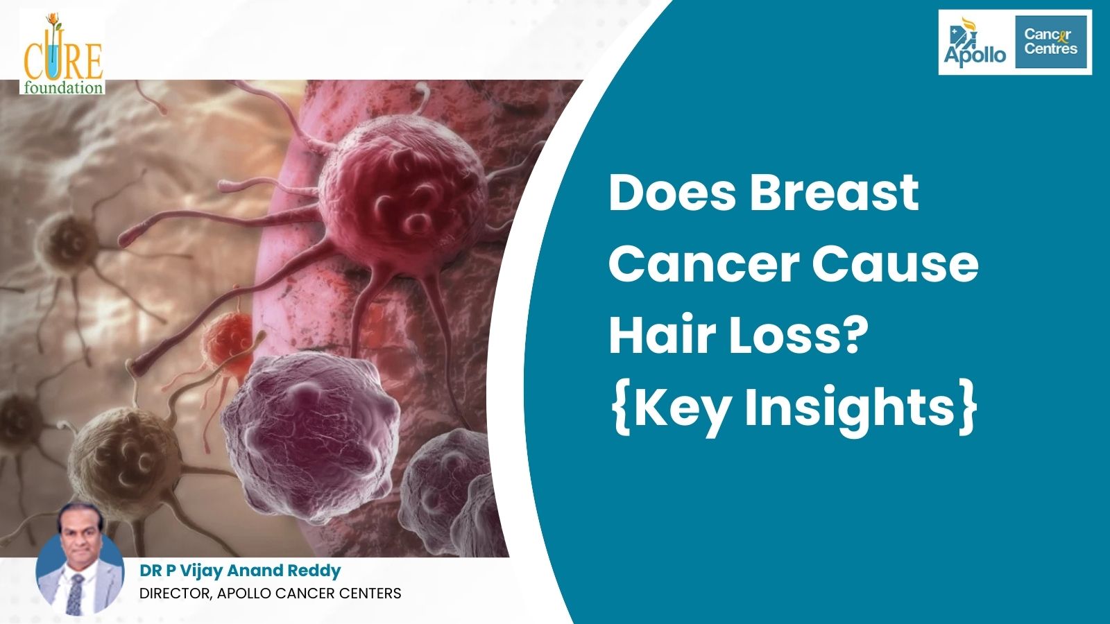 Does Breast Cancer Cause Hair Loss? {Key Insights}