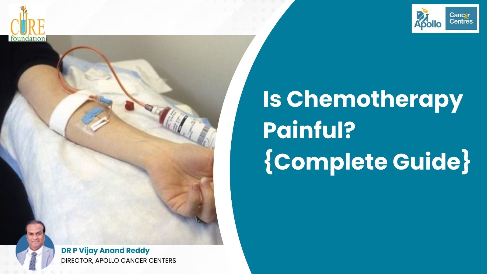 Is Chemotherapy Painful? {Complete Guide}