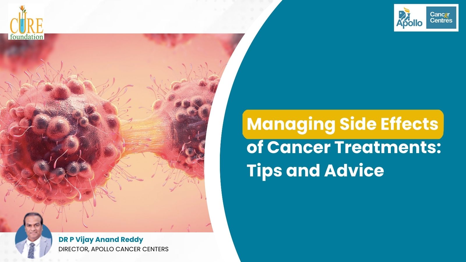 Managing Side Effects of Cancer Treatments: Tips and Advice