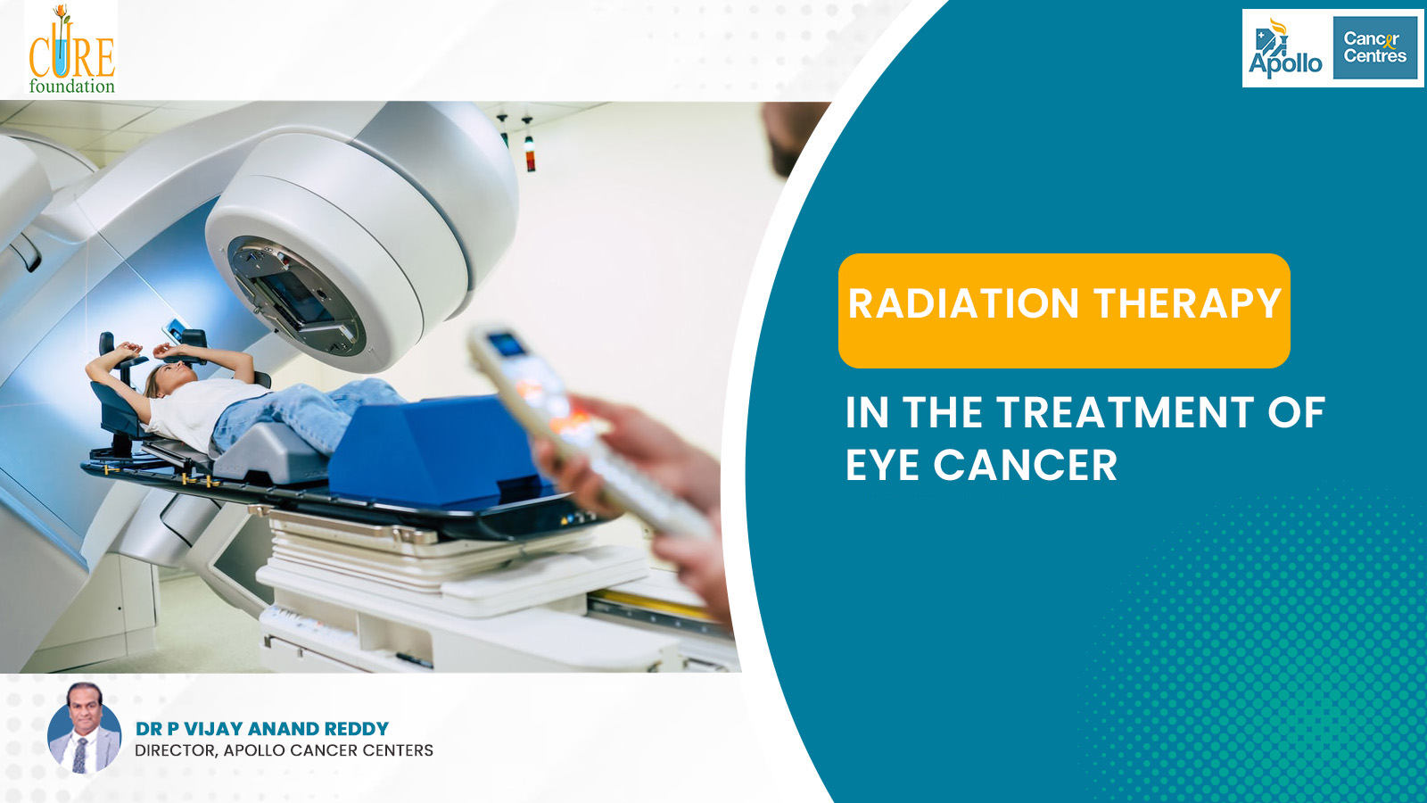 Radiation Therapy in the Treatment of Eye Cancer