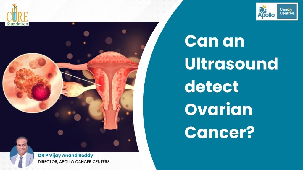 Can an Ultrasound Detect Ovarian Cancer?