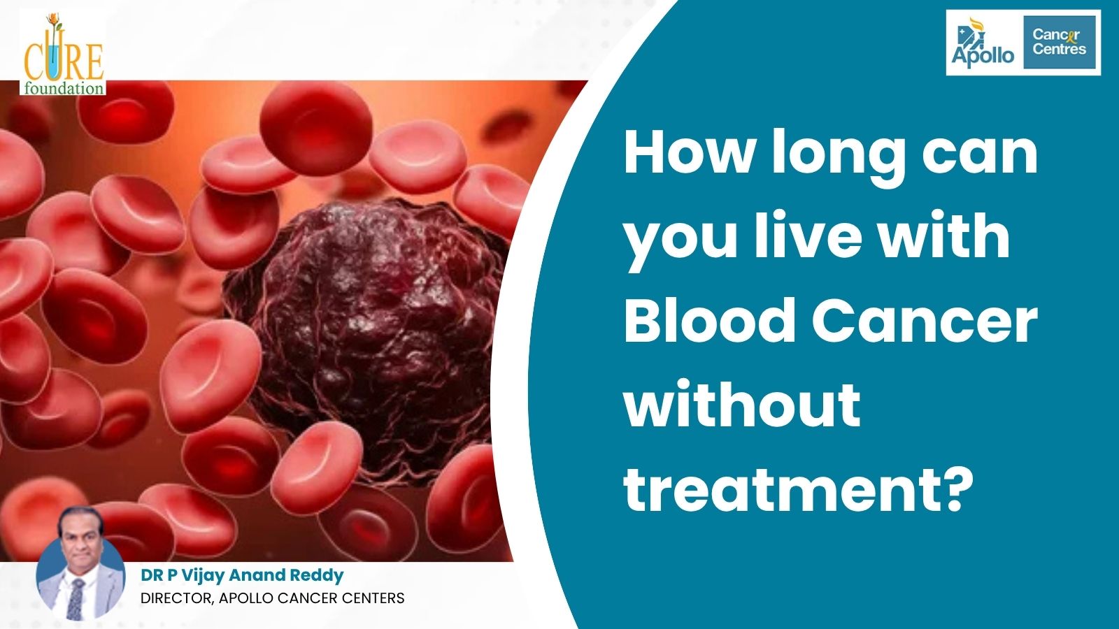 How Long Can You Live with Blood Cancer Without Treatment?