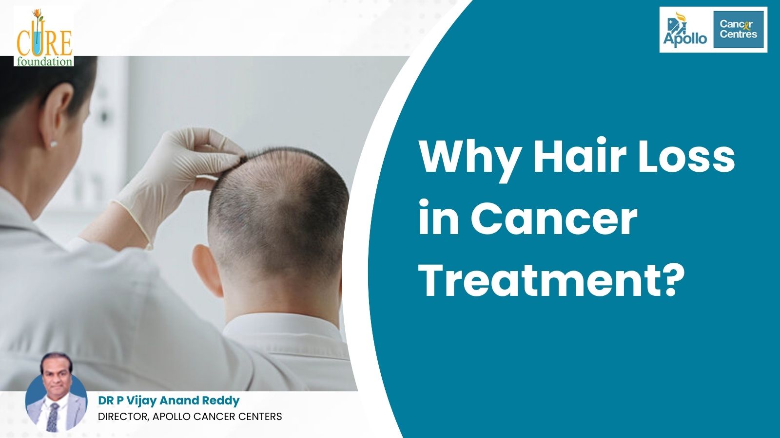 Why Hair Loss in Cancer Treatment?