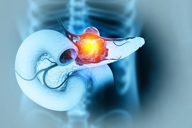 Medical Oncology